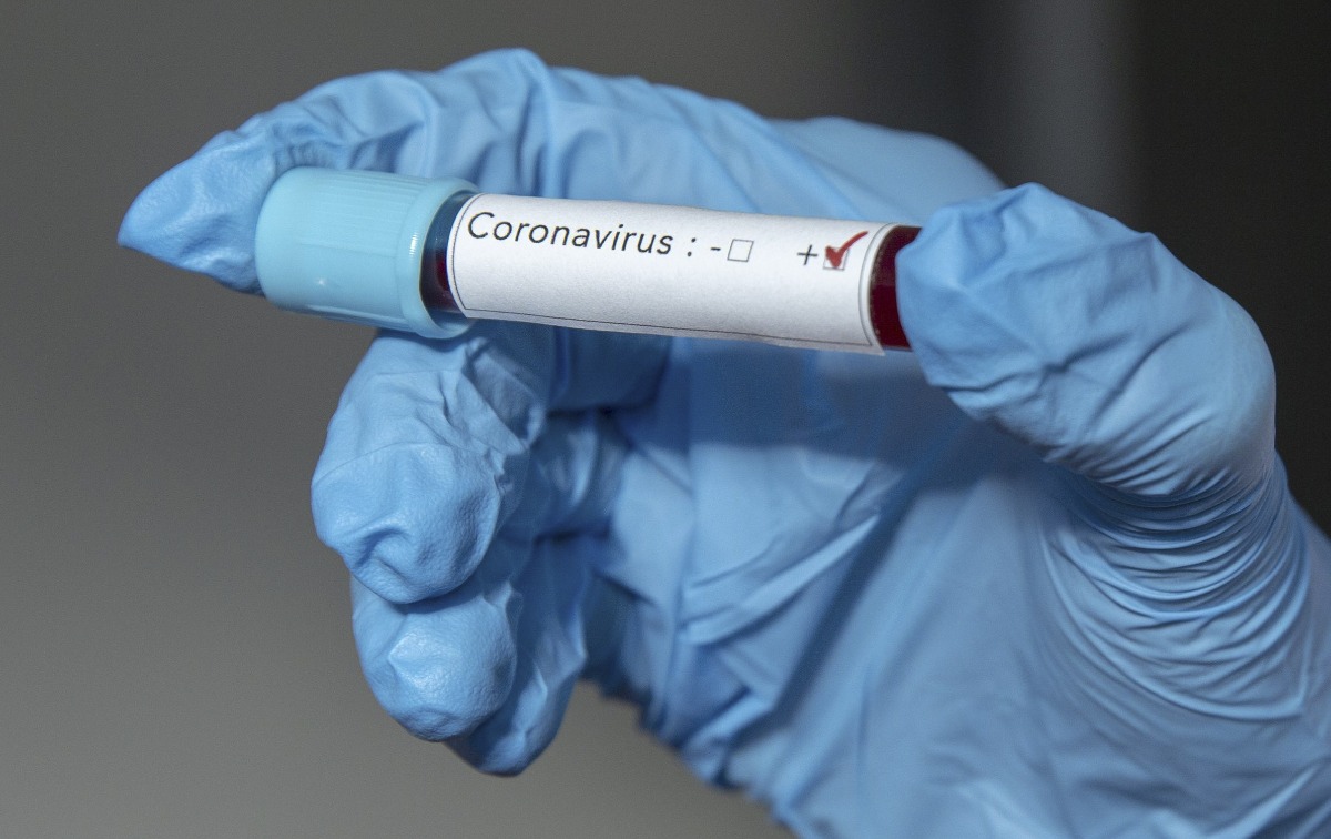 Sospechoso caso de Coronavirus Coronavirus en Cali