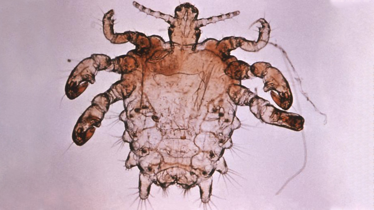 Ladilla Ladilla