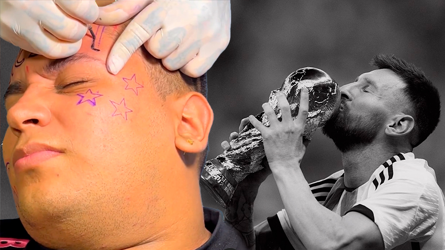 El calvario que vive joven colombiano que se tatuó a Messi en la cara