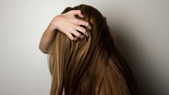 Alopecia