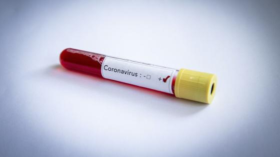 Coronavirus positivo