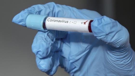 Coronavirus casos en Colombia