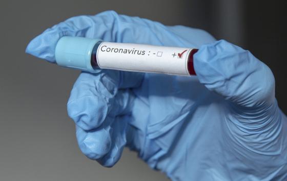 Sospechoso caso de Coronavirus Coronavirus en Cali