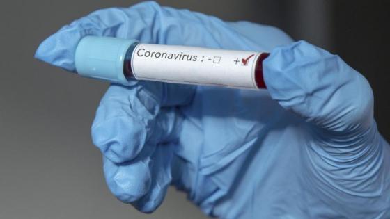 Primer caso de coronavirus en Perú