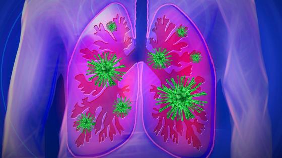 Personas son propensas a la mortalidad por coronavirus Personas son propensas a la mortalidad por coronavirus