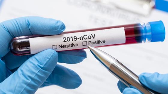 Pruebas coronavirus Nariño Pruebas coronavirus Nariño