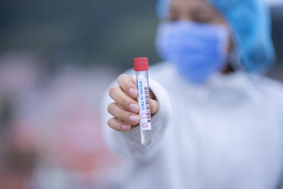 Test coronavirus Test coronavirus