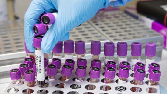 anticoagulante Heparina anticoagulante Heparina