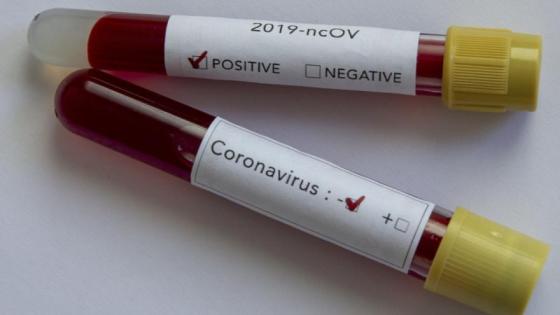 Casos nuevos de coronavirus en Colombia