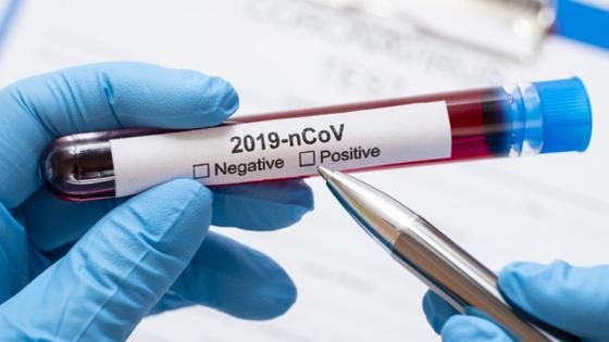 Casos positivos de coronavirus en el personal administrativo del Instituto Nacional de Cancerología