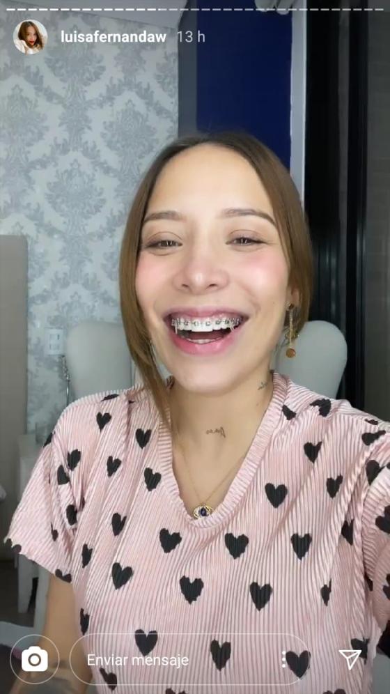 Luisa Fernanda W con brackets