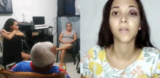 Así sobrevivió Arelys Naranjo a la brutal golpiza que le propinó su exnovio