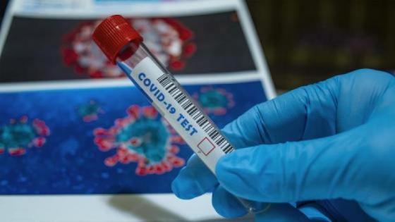 último reporte coronavirus en Colombia