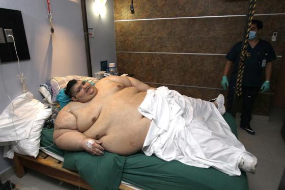 El hombre más gordo del mundo