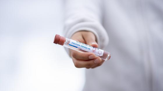 Coronavirus en Panamá Coronavirus en Panamá
