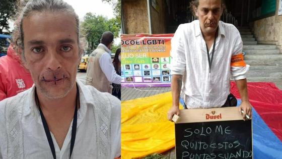Escultor se cosió la boca y permanece en huelga de hambre en el centro de Bogotá Escultor se cosió la boca y permanece en huelga de hambre en el centro de Bogotá
