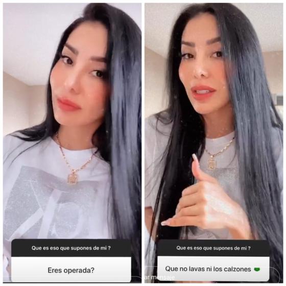 Marcela Reyes reveló a sus seguidores cuántas cirugías tiene Marcela Reyes reveló a sus seguidores cuántas cirugías tiene