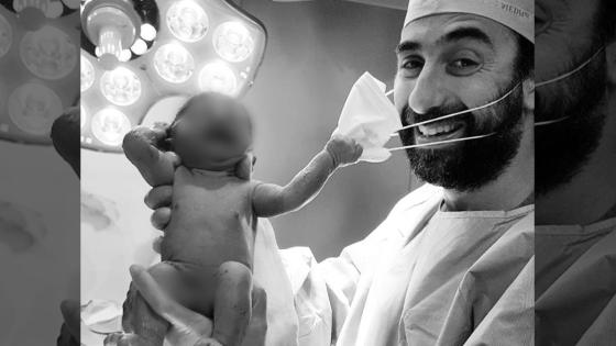 Bebé recién nacido que casi le quita el tapabocas a su médico, se vuelve viral