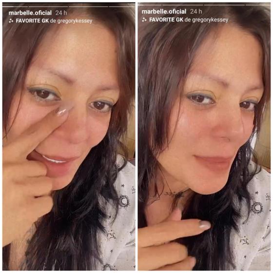 Esta es la nueva cirugía que le gustaría hacerse a Marbelle Esta es la nueva cirugía que le gustaría hacerse a Marbelle