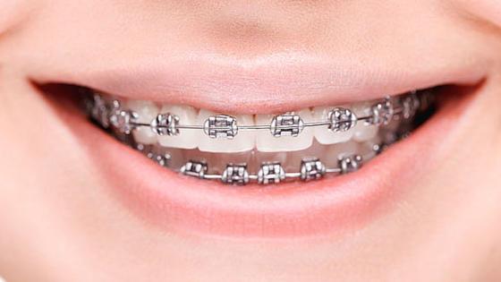 brackets brackets