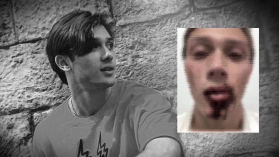 Responsables de la brutal golpiza al hijo de Sergio Araujo fueron condenados Responsables de la brutal golpiza al hijo de Sergio Araujo fueron condenados