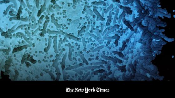 Una célula infectada con el nuevo coronavirus, tomada de la muestra de un paciente. Una célula infectada con el nuevo coronavirus, tomada de la muestra de un paciente.
