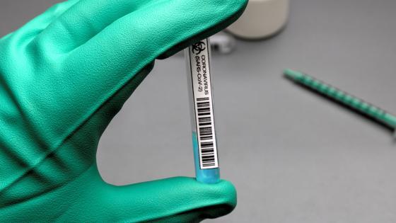 Casos de coronavirus Casos de coronavirus