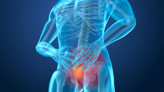 Cáncer de próstata Cáncer de próstata
