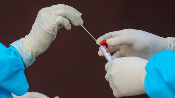 Coronavirus en Colombia: 7.248 casos nuevos de Covid-19