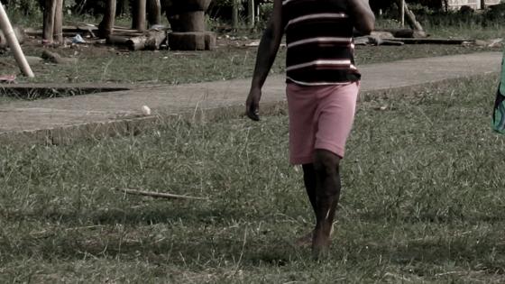 Niño emberá perdió una pierna por mina antipersona en Antioquia Niño emberá perdió una pierna por mina antipersona en Antioquia