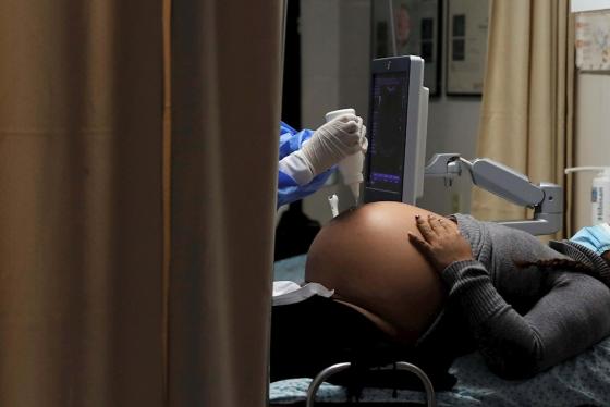 Brasil reporta aumento de muertes en mujeres embarazadas por Covid-19 Brasil reporta aumento de muertes en mujeres embarazadas por Covid-19