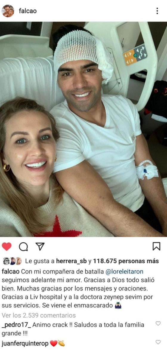Tras fractura en el rostro Falcao García da parte de tranquilidad Tras fractura en el rostro Falcao García da parte de tranquilidad