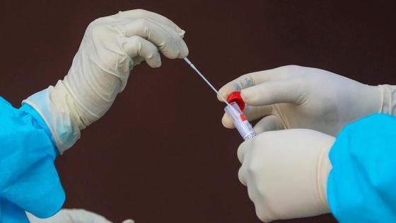 Coronavirus en Colombia: reportan 23.487 casos nuevos