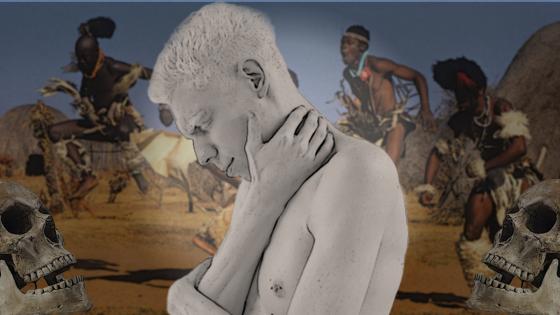 La ONU denuncia el aumento de casos de asesinatos rituales de albinos durante la pandemia. Hechicería con albinos durante la pandemia.