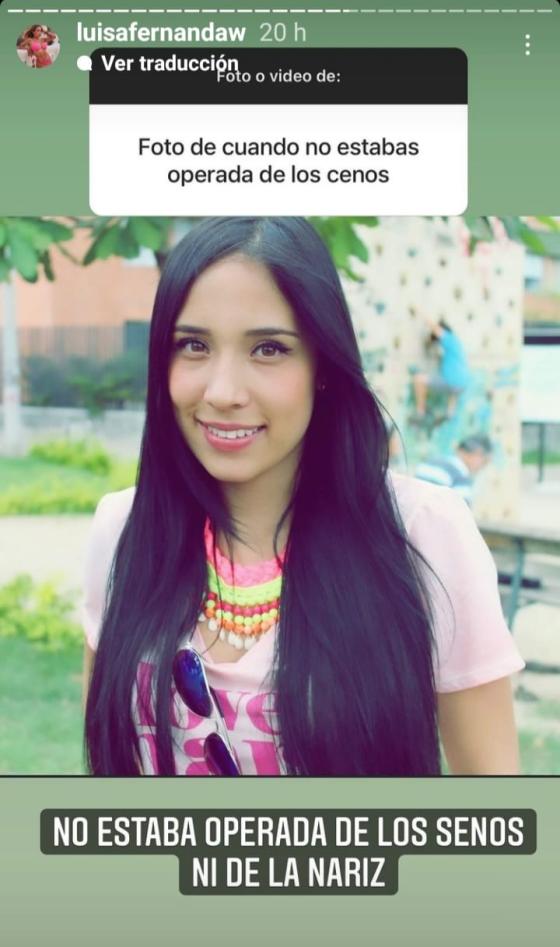 Luisa Fernanda W antes de sus cirugías Luisa Fernanda W antes de sus cirugías