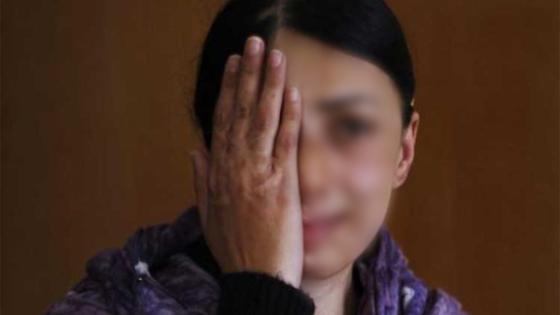 Nuevo ataque con ácido en la localidad de Chapinero, Bogotá Nuevo ataque con ácido en la localidad de Chapinero, Bogotá
