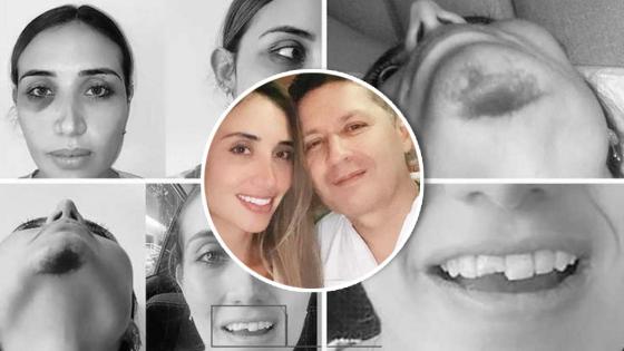 Médica denuncia brutal golpiza a manos de un cirujano en Bucaramanga Médica denuncia brutal golpiza a manos de un cirujano en Bucaramanga