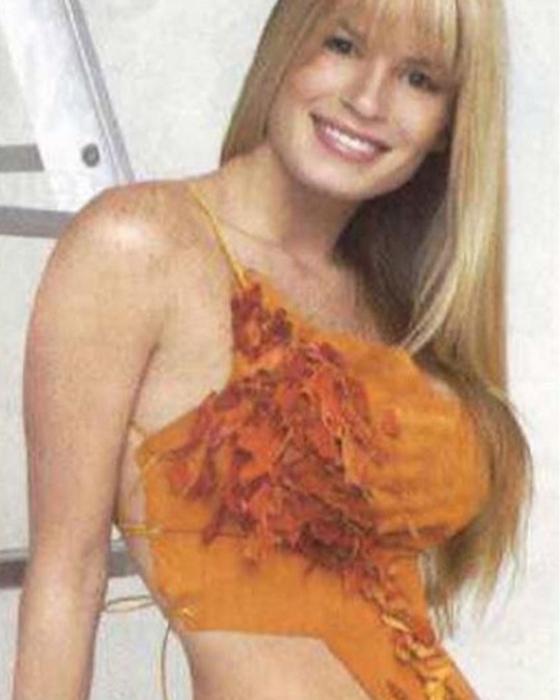 Mary Méndez antes y despúes Mary Méndez antes y despúes