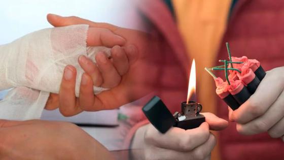 Quemados por pólvora Quemados por pólvora