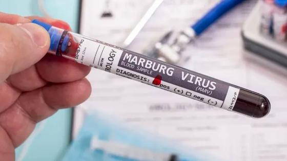 Virus de Marburgo