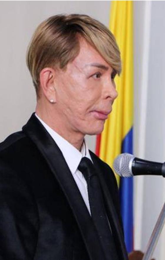 Norberto: Este ha sido su gran cambio físico Norberto: Este ha sido su gran cambio físico