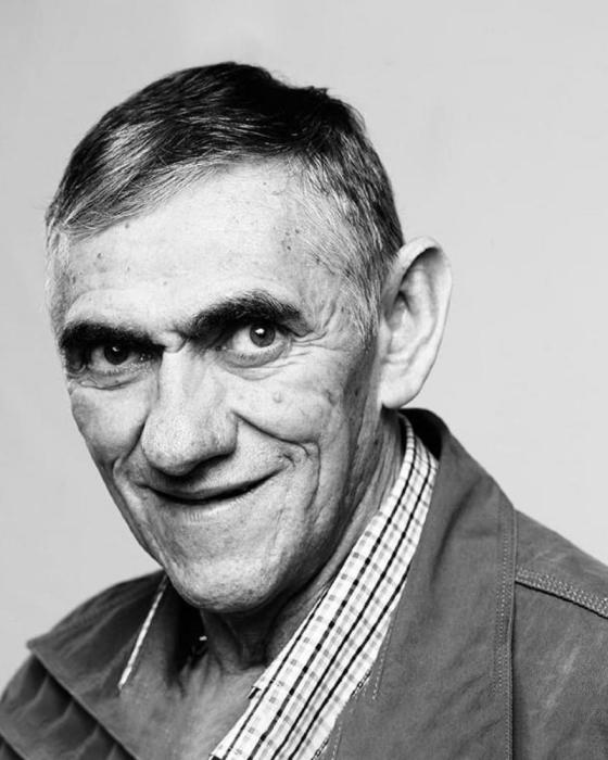 Comediantes que fallecieron Mandibula