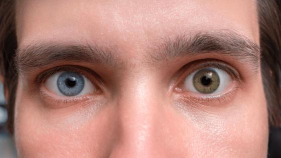 Cuál es el origen de tener los ojos de distintos colores. Cuál es el origen de tener los ojos de distintos colores.
