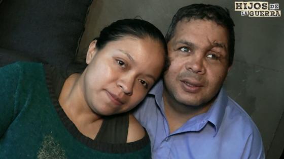 Víctimas de minas antipersona Víctimas de minas antipersona