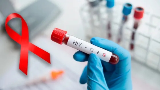 Nuevo método de prevención contra el VIH se ensaya en Sudáfrica Nuevo método de prevención contra el VIH se ensaya en Sudáfrica