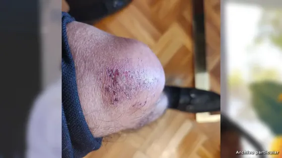 Petro rodilla Petro rodilla