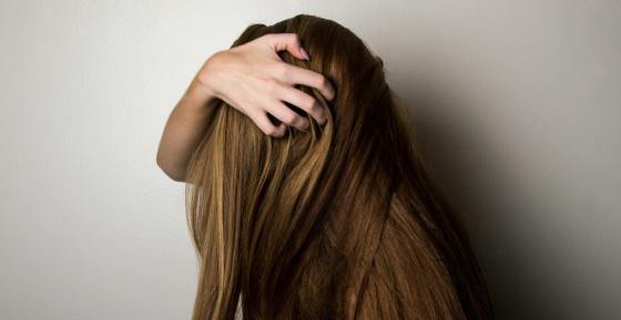 Alopecia femenina Alopecia