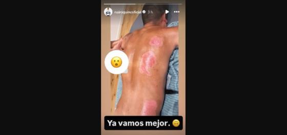 Nairo Quintana Nairo Quintana