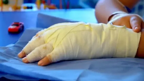 Alcohol y pólvora: 26 casos y 22 menores en Bogotá antes de Año Nuevo