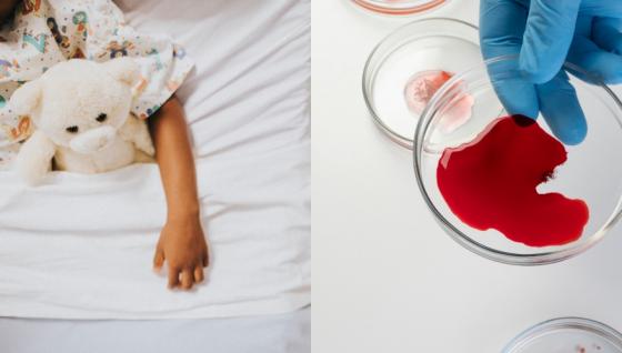 Imagen de referencia de niño con hemofilia. 